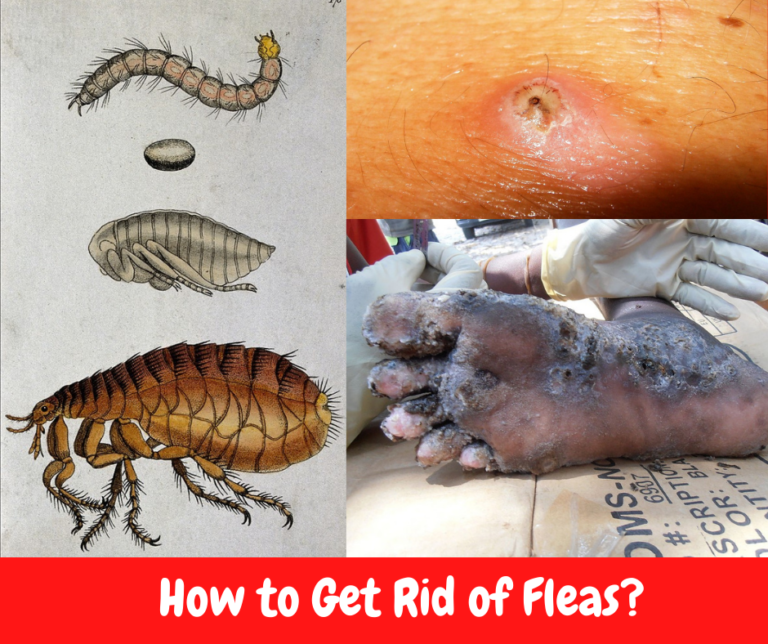 How To Get Rid Of Fleas Businessmag