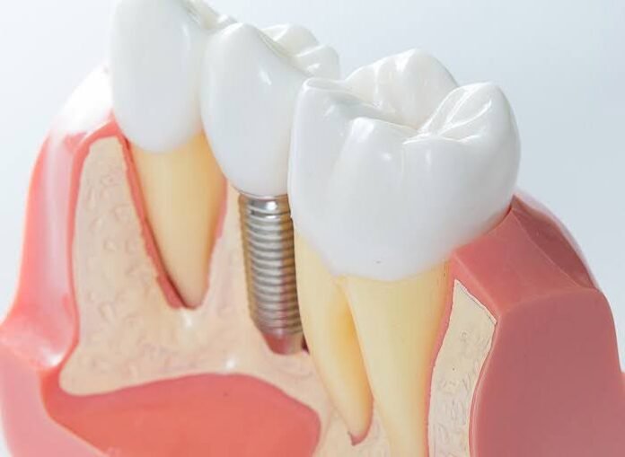 Revolutionizing Smiles